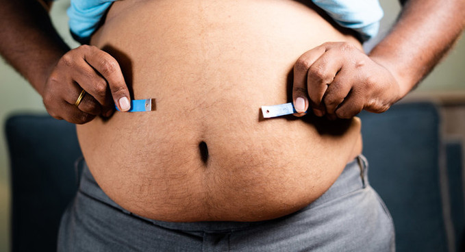 전 세계 감염 관련 사망의 10분의 1은 심각한 비만 때문